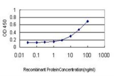 ELISA: LIM kinase 2 Antibody (2H2-E11) [H00003985-M01]