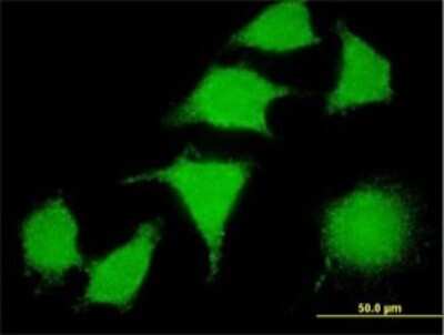 Immunocytochemistry/ Immunofluorescence: LIM kinase 2 Antibody (2H2-E11) [H00003985-M01]