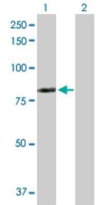 Western Blot: LIM kinase 2 Antibody [H00003985-D01P]