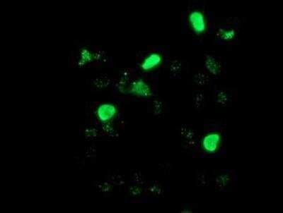 Immunocytochemistry/ Immunofluorescence: LIM1 Antibody (OTI2D5) [NBP2-01926]