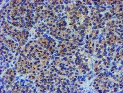 Immunohistochemistry-Paraffin: LIM1 Antibody (OTI2D5) [NBP2-01926]