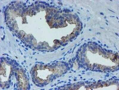 Immunohistochemistry: LIM1 Antibody (OTI2D5) - Azide and BSA Free [NBP2-71134]