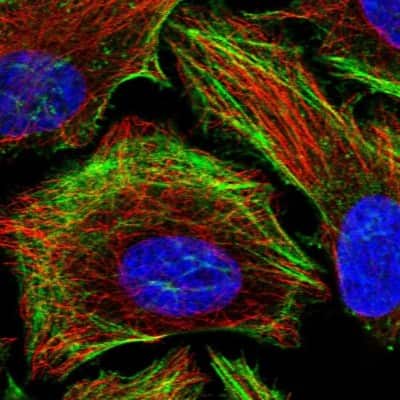 Immunocytochemistry/ Immunofluorescence: LIMCH1 Antibody [NBP2-39006]