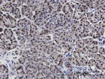 Immunohistochemistry-Paraffin: LIMD1 Antibody (2G5) [H00008994-M01]