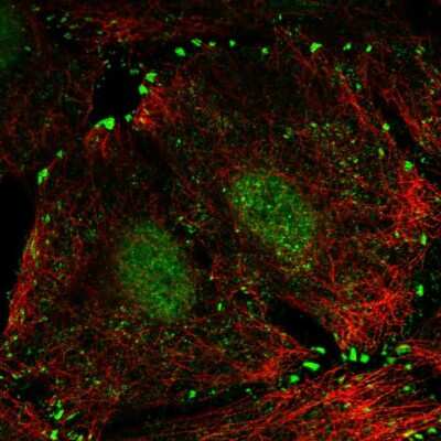 Immunocytochemistry/ Immunofluorescence: LIMD1 Antibody [NBP2-56448]