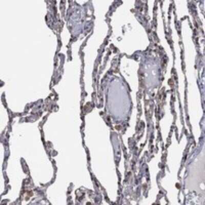 Immunohistochemistry-Paraffin: LIMD1 Antibody [NBP3-17878]