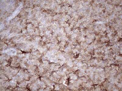 Immunohistochemistry: LIME Antibody (OTI5D3) [NBP2-45653]