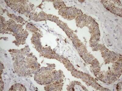 Immunohistochemistry: LIME Antibody (OTI5D3) - Azide and BSA Free [NBP2-71974]