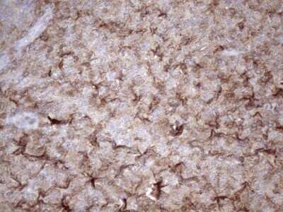 Immunohistochemistry: LIME Antibody (OTI5D3) - Azide and BSA Free [NBP2-71974]
