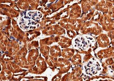 Immunohistochemistry-Paraffin: LIMPII/SR-B2 Antibody (052) [NBP2-90382]