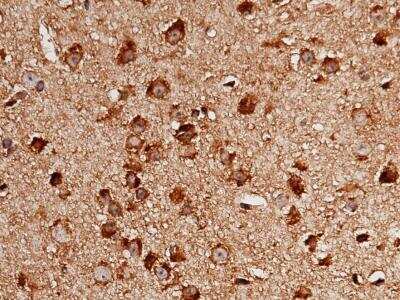Immunohistochemistry-Paraffin: LIMPII/SR-B2 Antibody (052) [NBP2-90382]