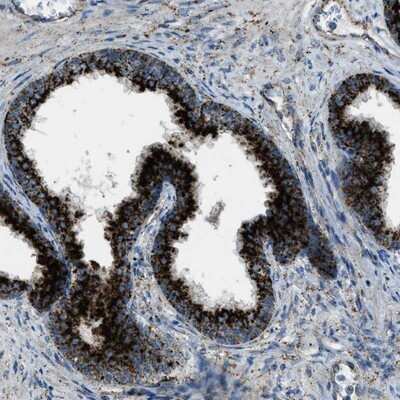 Immunohistochemistry-Paraffin: LIMPII/SR-B2 Antibody [NBP1-84583]