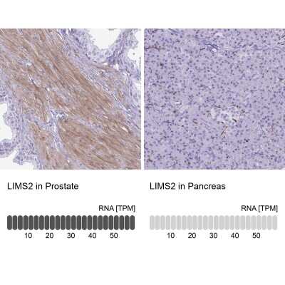 Immunohistochemistry-Paraffin: LIMS2 Antibody [NBP2-31713]