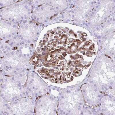 Immunohistochemistry-Paraffin: LIMS2 Antibody [NBP2-31713]