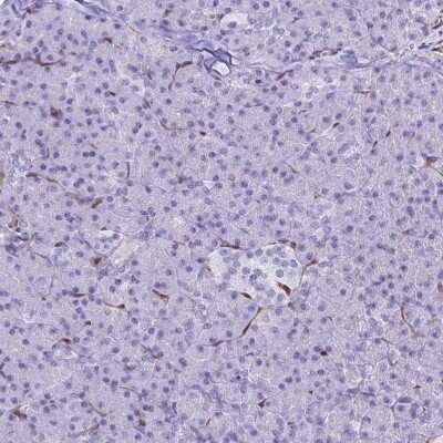 Immunohistochemistry-Paraffin: LIMS2 Antibody [NBP2-31713]