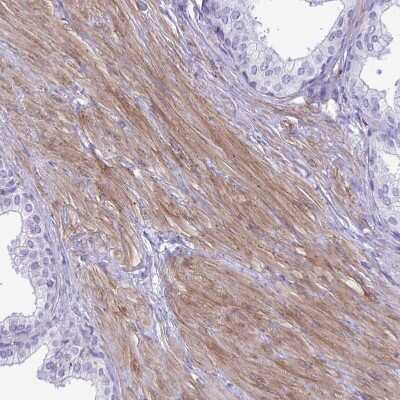Immunohistochemistry-Paraffin: LIMS2 Antibody [NBP2-31713]