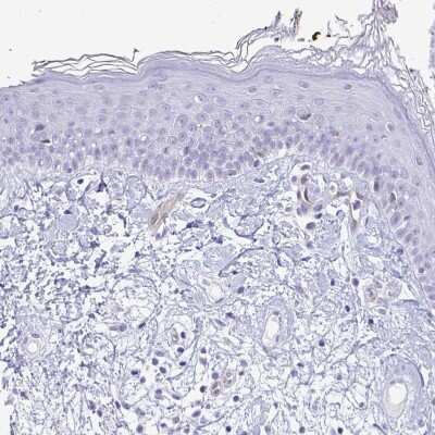 Immunohistochemistry-Paraffin: LIMS2 Antibody [NBP2-31713]