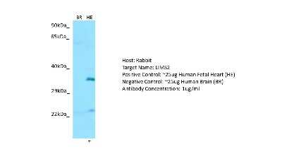 Western Blot: LIMS2 Antibody [NBP2-85209]