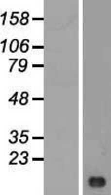 Western Blot: LIMS3 Overexpression Lysate [NBL1-12540]