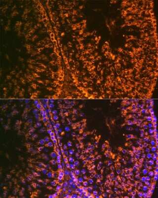 Immunohistochemistry: LIN-28A Antibody (2S1I10) [NBP3-16843]