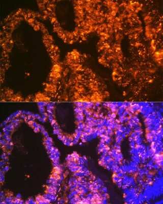Immunohistochemistry: LIN-28A Antibody (2S1I10) [NBP3-16843]