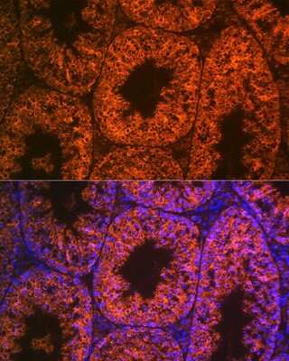 Immunohistochemistry: LIN-28A Antibody (2S1I10) [NBP3-16843]