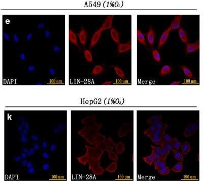 Immunocytochemistry/ Immunofluorescence: LIN-28A Antibody [NBP1-49537]