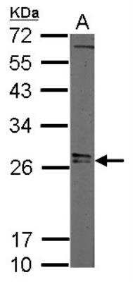 Western Blot: LIN-28A Antibody [NBP2-19355]