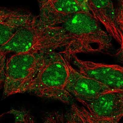 Immunocytochemistry/ Immunofluorescence: LIN-28B Antibody [NBP2-32352]