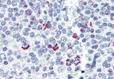 Immunohistochemistry-Paraffin: LIN-28B Antibody [NBP1-50529]