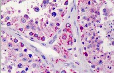 Immunohistochemistry-Paraffin: LIN-28B Antibody [NBP1-50529]