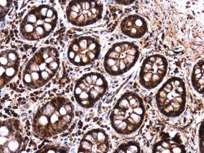 Immunohistochemistry-Paraffin: LIN-28B Antibody [NBP3-13029]