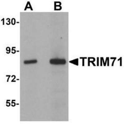 Western Blot: LIN-41/TRIM71 AntibodyBSA Free [NBP1-76281]