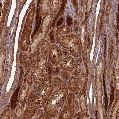 Immunohistochemistry-Paraffin: LIN10 Antibody [NBP1-88453]