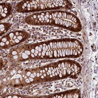 Immunohistochemistry-Paraffin: LIN10 Antibody [NBP1-88454]