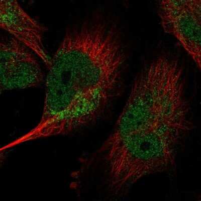 Immunocytochemistry/ Immunofluorescence: LIN37 Antibody [NBP2-30637]