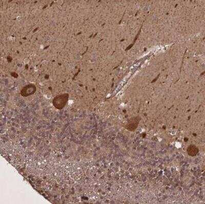 Immunohistochemistry-Paraffin: LIN37 Antibody [NBP2-30384]