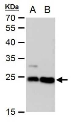 Western Blot: LIN7 Antibody (377) [NBP2-43587]