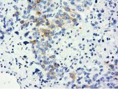 Immunohistochemistry-Paraffin: LIN7B Antibody (OTI1C9) [NBP2-02852]