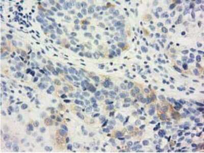 Immunohistochemistry-Paraffin: LIN7B Antibody (OTI1C9) [NBP2-02852]