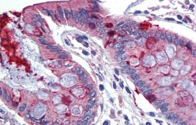 Immunohistochemistry-Paraffin: LIN7C Antibody [NBP1-53082]
