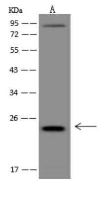 Western Blot: LIN7C Antibody [NBP3-06033]