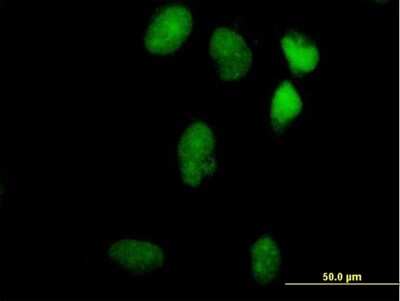 Immunocytochemistry/ Immunofluorescence: LIN9 Antibody [H00286826-B01P]