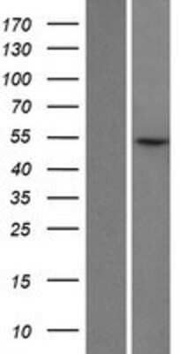 Western Blot: LIN9 Overexpression Lysate [NBP2-05151]
