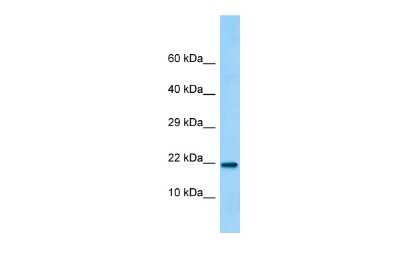 Western Blot: LINC02694 Antibody [NBP2-82850]