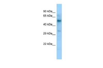 Western Blot: LIPC Antibody [NBP3-09422]