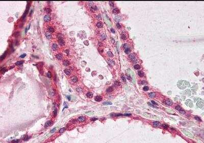 Immunohistochemistry-Paraffin: LIS1 Antibody [NB100-1040]