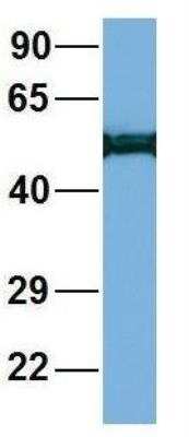 Western Blot: LIV-1/Zip6 Antibody [NBP1-59357]