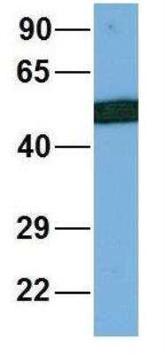 Western Blot: LIV-1/Zip6 Antibody [NBP1-59357]
