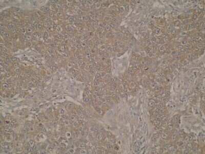Immunohistochemistry: LKAAEAR1 Antibody (Z36P2C1*E7) - BSA Free [NBP2-50477]